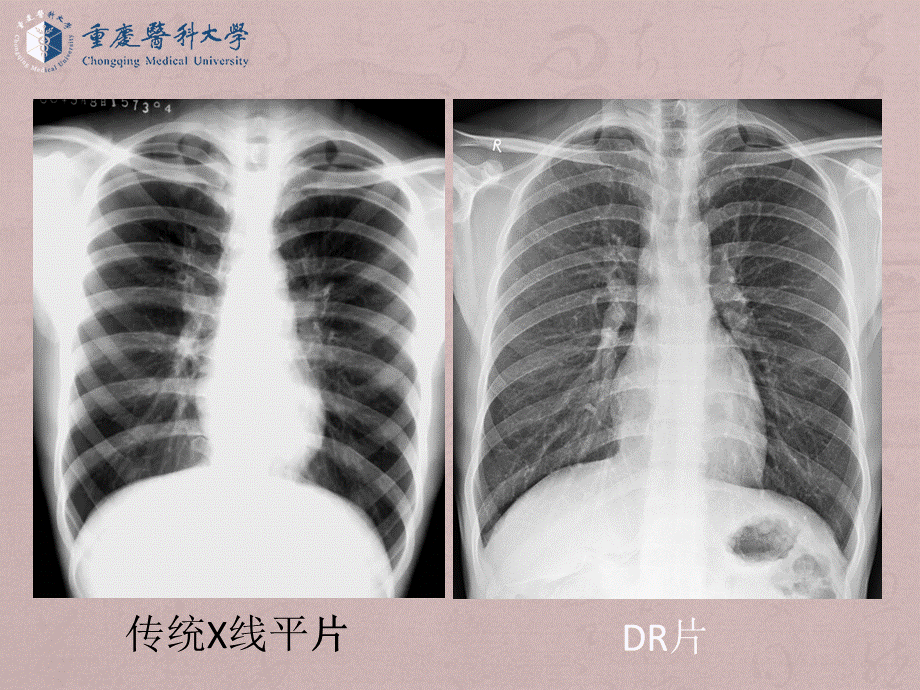 （全是图）医学七年制呼吸循环系统教学.ppt_第1页