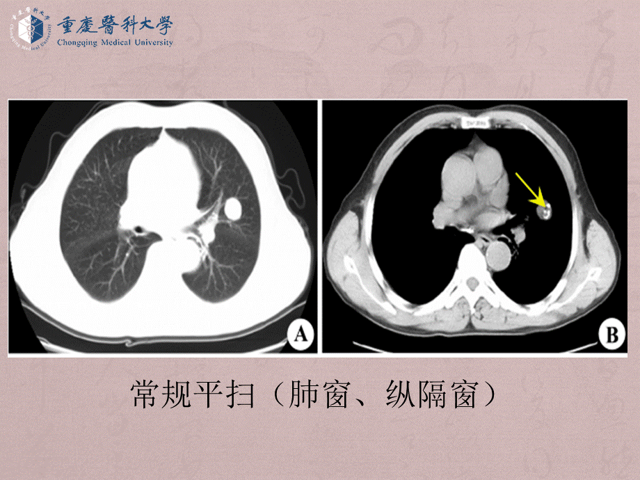 （全是图）医学七年制呼吸循环系统教学.ppt_第2页