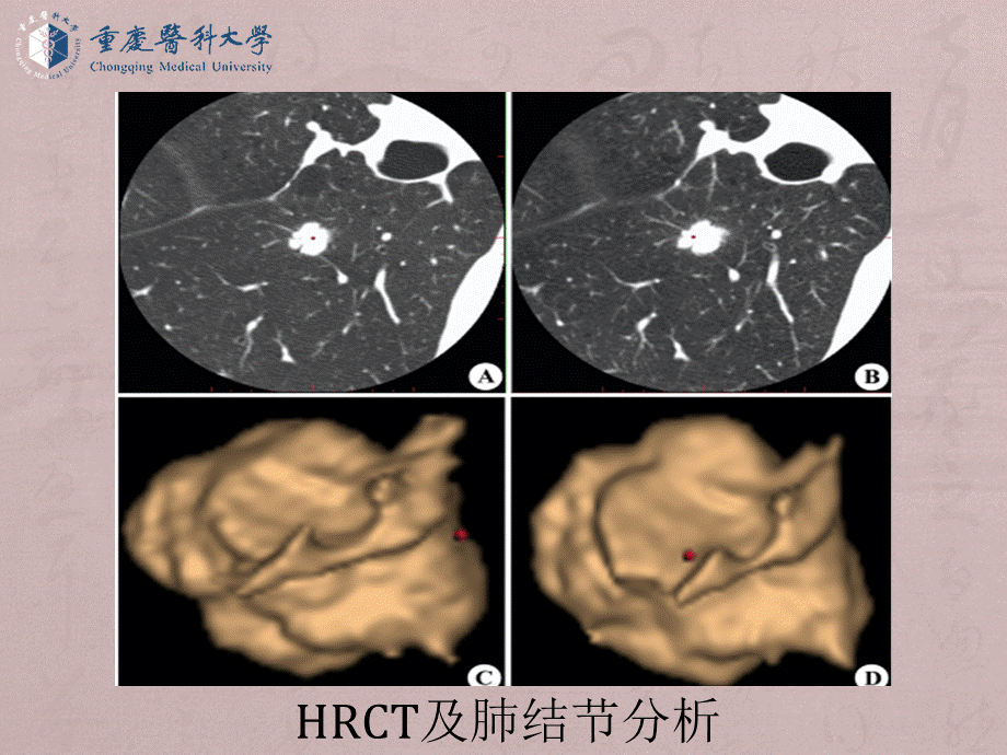 （全是图）医学七年制呼吸循环系统教学.ppt_第3页