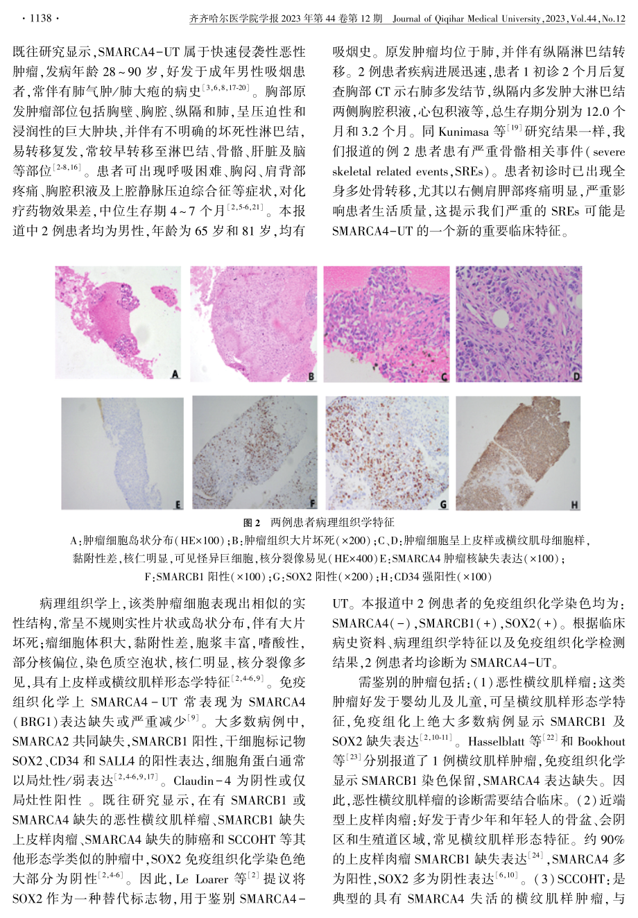 胸部SMARCA4缺失型未分化肿瘤2例.pdf_第3页