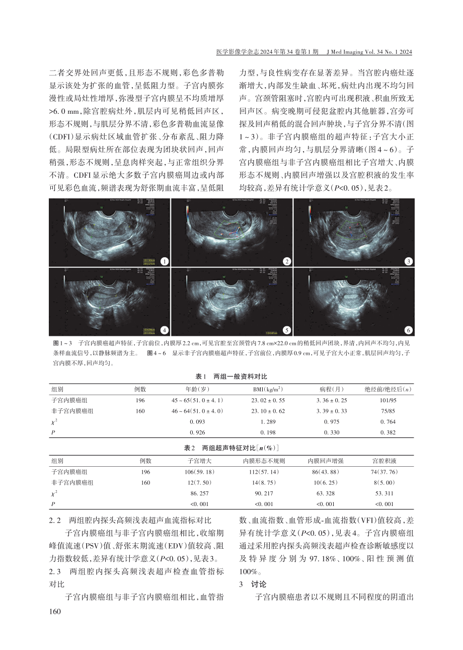 高频浅表超声检查诊断子宫内膜癌的临床价值.pdf_第2页