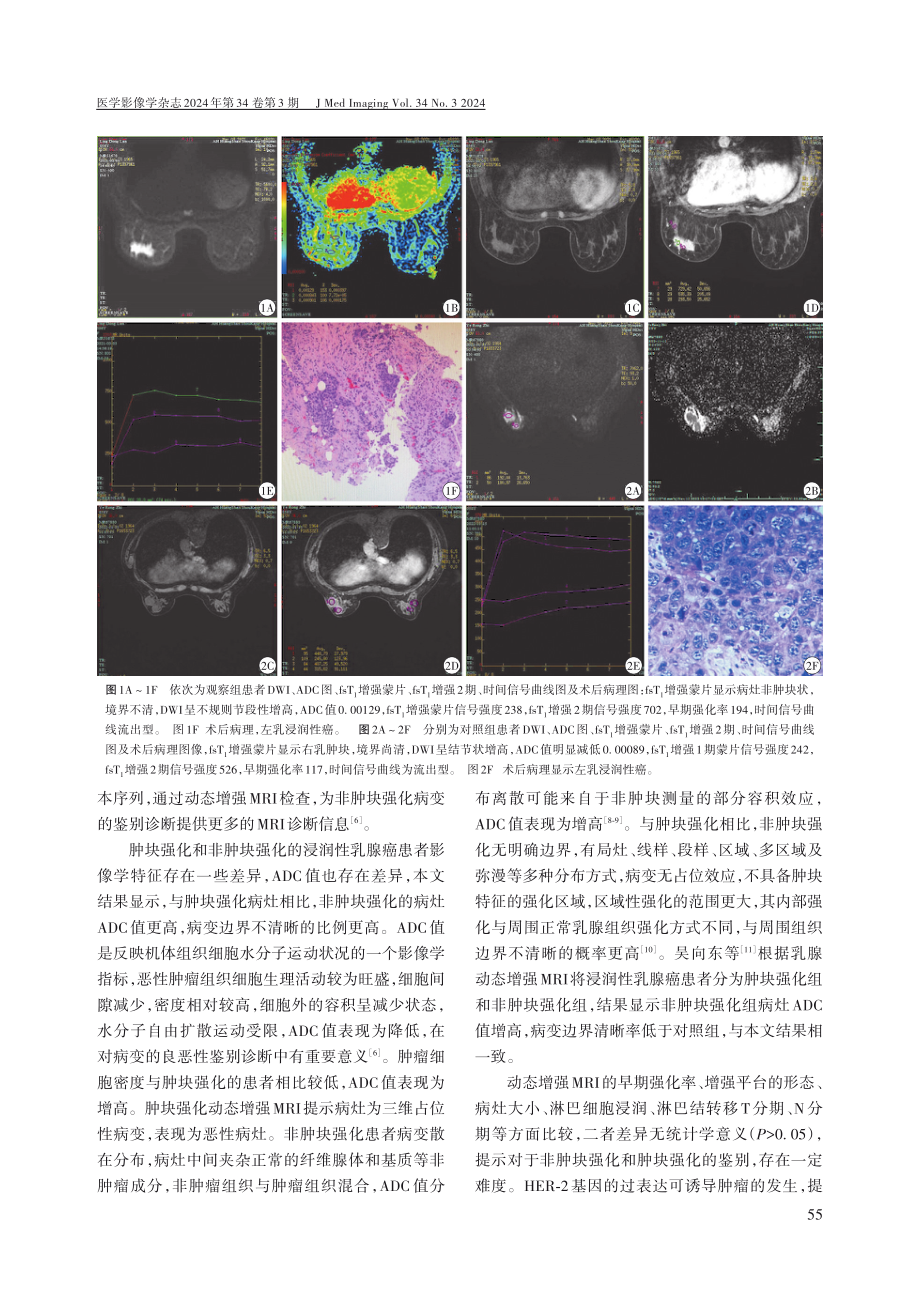 浸润性乳腺癌患者非肿块强化和肿块强化的动态增强MRI特征分析.pdf_第3页