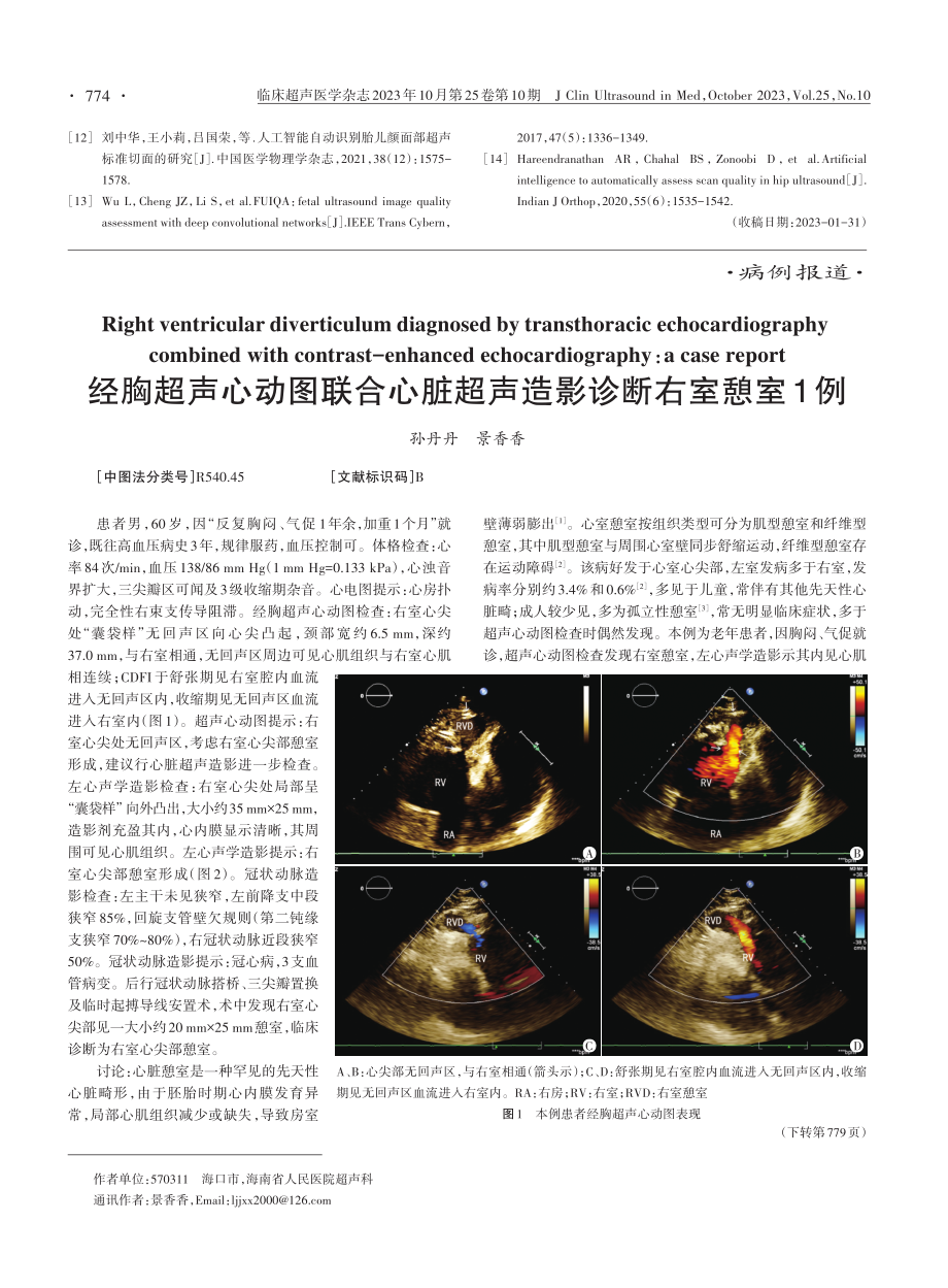 经胸超声心动图联合心脏超声造影诊断右室憩室1例.pdf_第1页