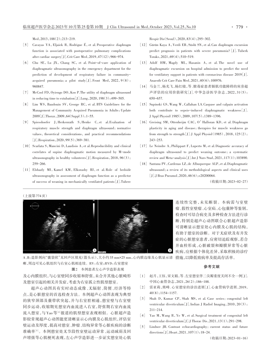 经胸超声心动图联合心脏超声造影诊断右室憩室1例.pdf_第2页