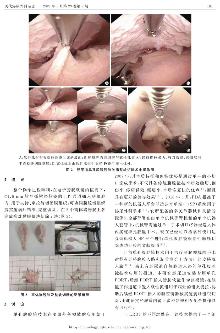 经尿道单孔腔镜膀胱肿瘤整块切除术的离体动物模型实验研究.pdf_第3页