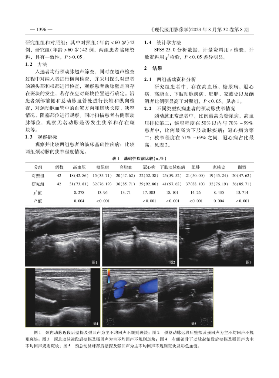 颈动脉超声筛查在颈动脉狭窄与脑卒中高危人群中的准确性及灵敏性分析.pdf_第2页