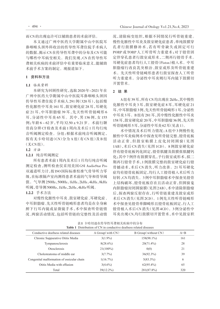 卡哈切迹在传导性耳聋相关疾病术前评估中的意义.pdf_第2页